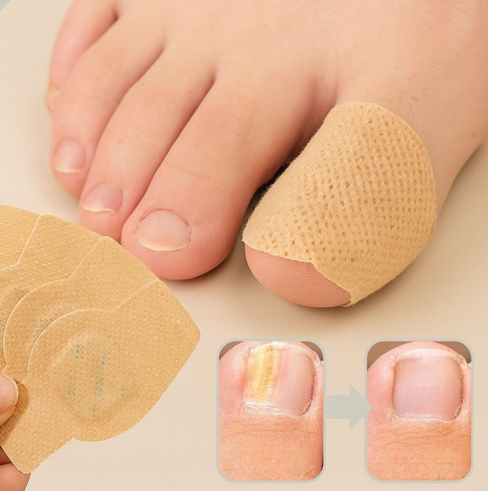 Nighttime Fungal Nail Treatment Patches – Anti-Fungal Nail Repair Kit