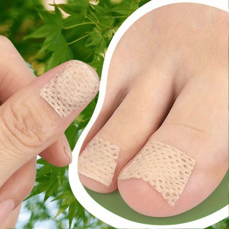 Nighttime Fungal Nail Treatment Patches – Anti-Fungal Nail Repair Kit